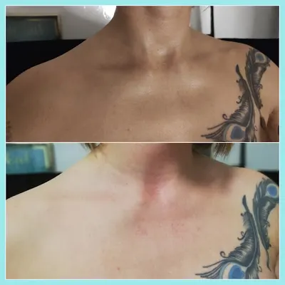 Opalanie natryskowe St. Tropez Gdynia